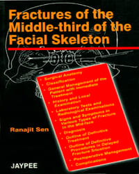 Fractures Of The Middle-Third Of The Facial Skeleton