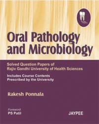 Oral Pathology And Microbiology:Solved Question Papers Of Rajiv Gandhi University Of Health Sciences