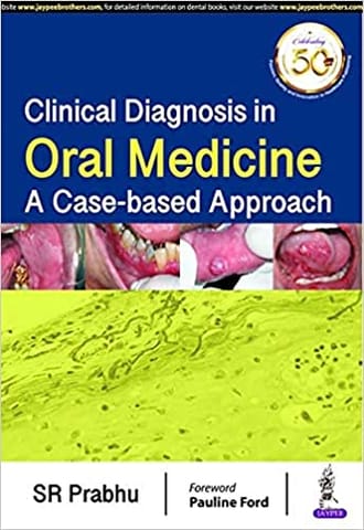 Clinical Diagnosis In Oral Medicine: A Case-Based Approach