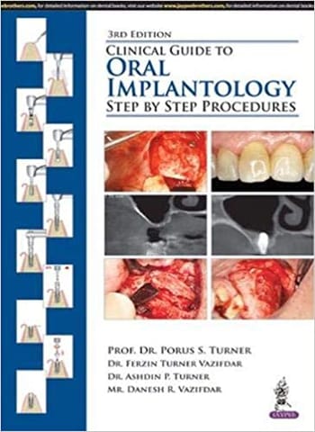 Clinical Guide To Oral Implantology:Step By Step Procedures