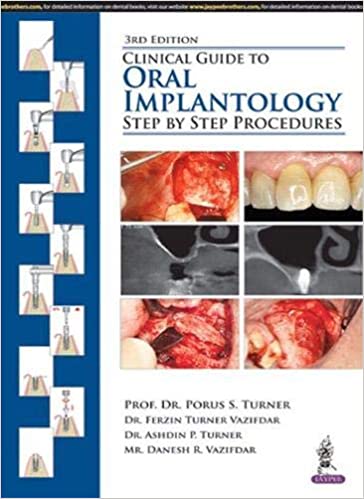 Clinical Guide To Oral Implantology:Step By Step Procedures