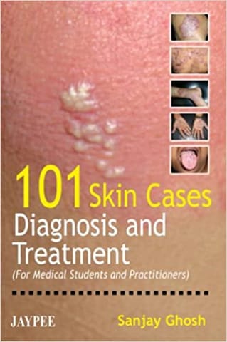 101 Skin Cases Diagnosis And Treatment(For Med.Stu.And Pract.)