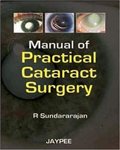Manual of Practical Cataract Surgery