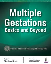 Multiple Gestations:Basics And Beyond (Paperback)