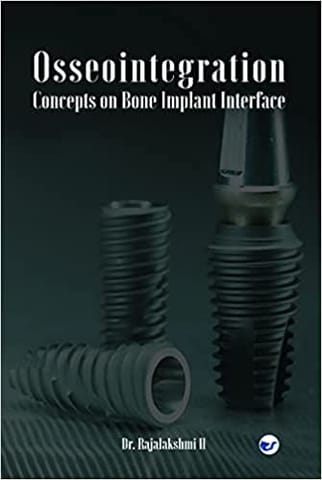 Osseointegration - Concepts On Bone Implant Interface