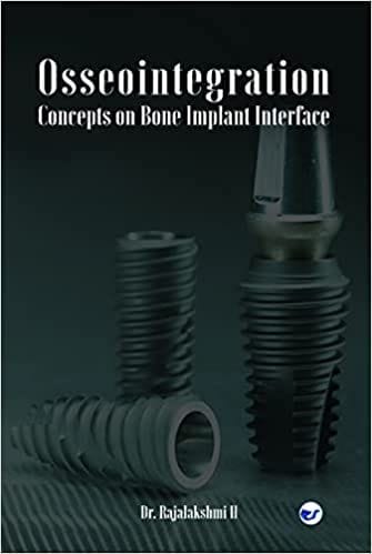 Osseointegration - Concepts On Bone Implant Interface