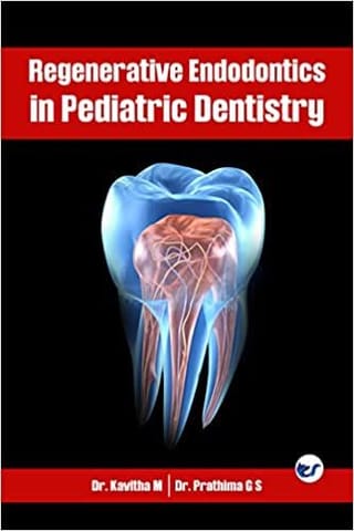 Regenerative Endodontics In Pediatric Dentistry