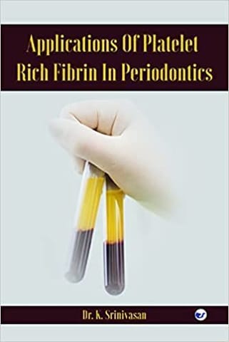 Applications Of Platelet Rich Fibrin In Periodontics