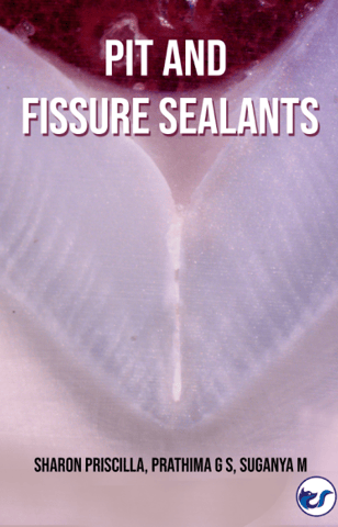 Pit And Fissure Sealants