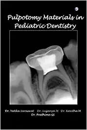 Pulpotomy Materials In Pediatric Dentistry