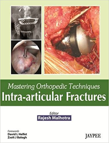 Mastering Orthopedic Techniques Intra-Articular Fractures