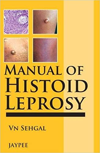Manual Of Histoid Leprosy (Paperback)