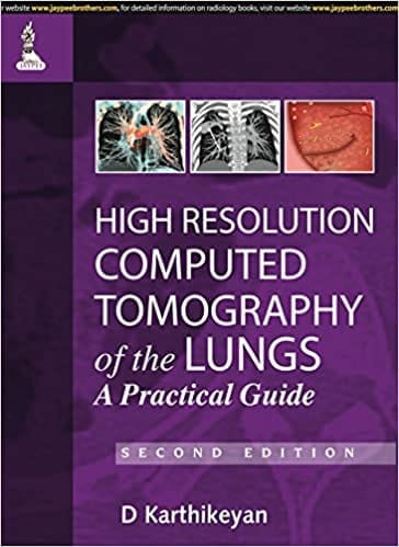 High Resolution Computed Tomography Of The Lungs A Practical Guide (Hardcover)