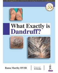 WHAT EXACTLY IS DANDRUFF