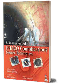 MANAGEMENT OF PHACO COMPLICATIONS NEWER TECHNIQUES INCLUDES 2 INT.DVD-ROM