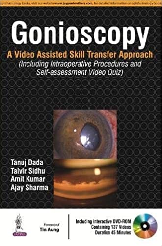GONIOSCOPY:A VIDEO ASSISTED SKILL TRANSFER APPROACH WITH DVD-ROM