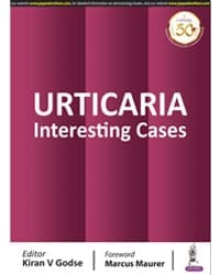 URTICARIA: INTERESTING CASES