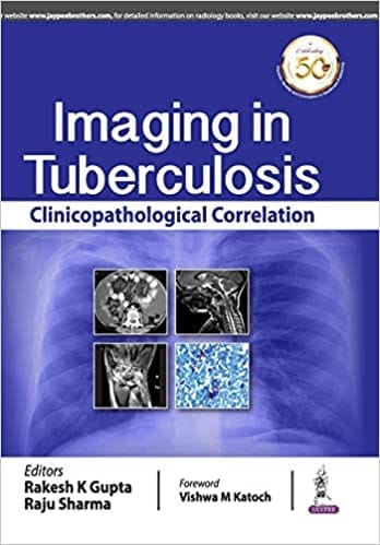 IMAGING IN TUBERCULOSIS: CLINICOPATHOLOGICAL CORRELATION
