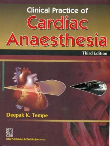 Cardiac  Ansthesia